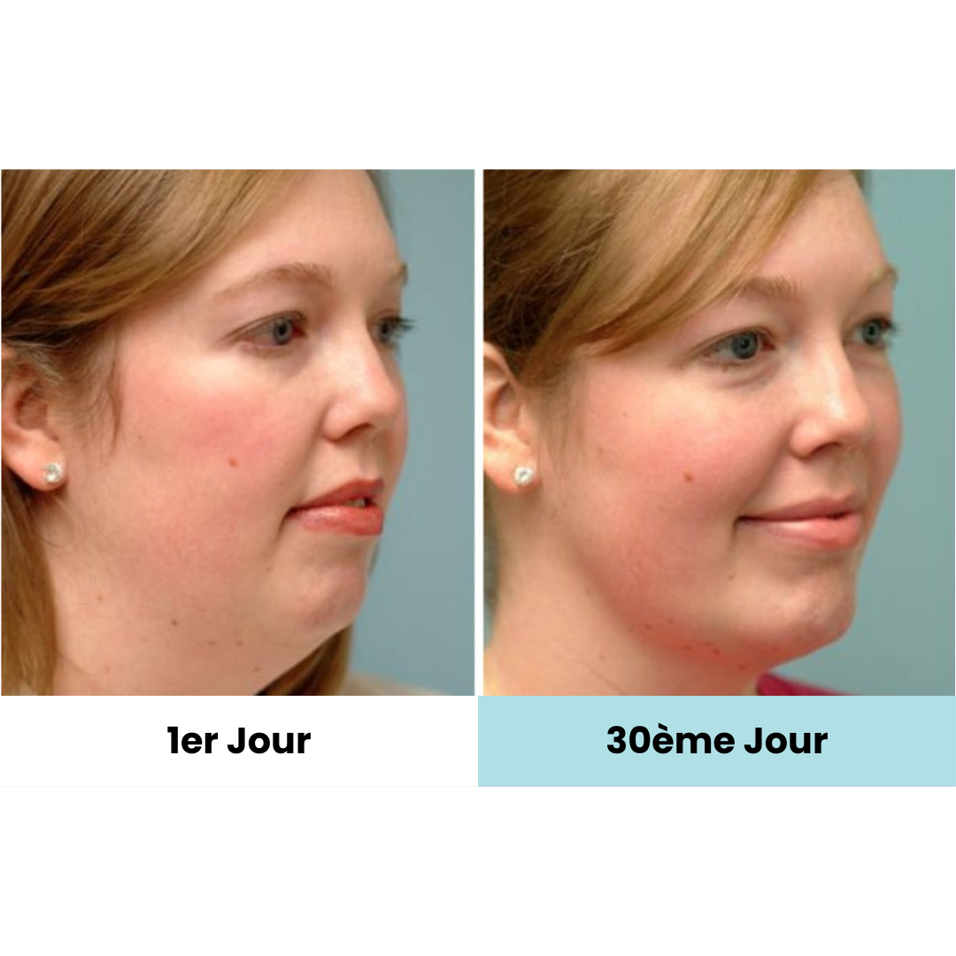 ElokoLifting – Massage LED pour une Peau Jeune et Ferme