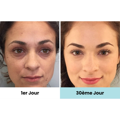 ElokoLifting – Massage LED pour une Peau Jeune et Ferme