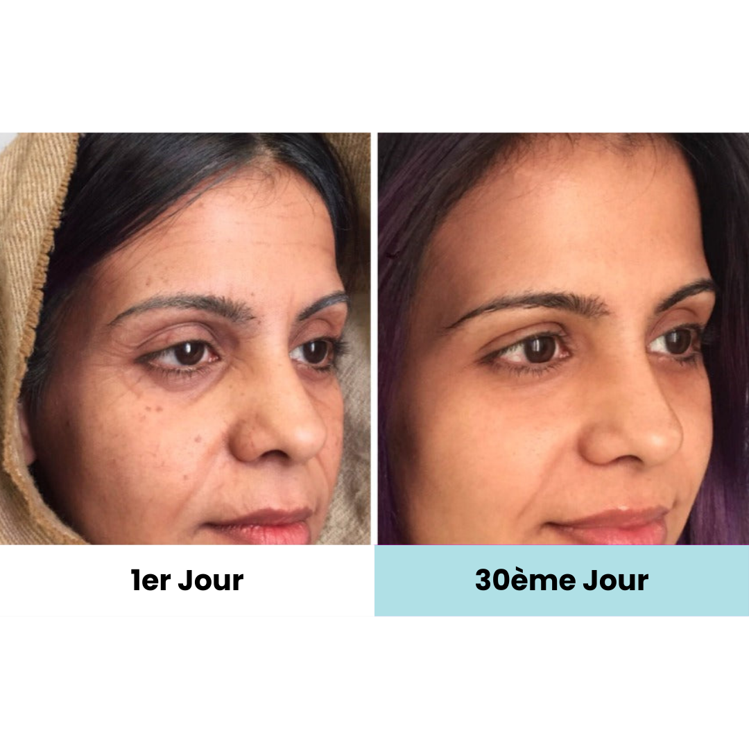 ElokoLifting – Massage LED pour une Peau Jeune et Ferme